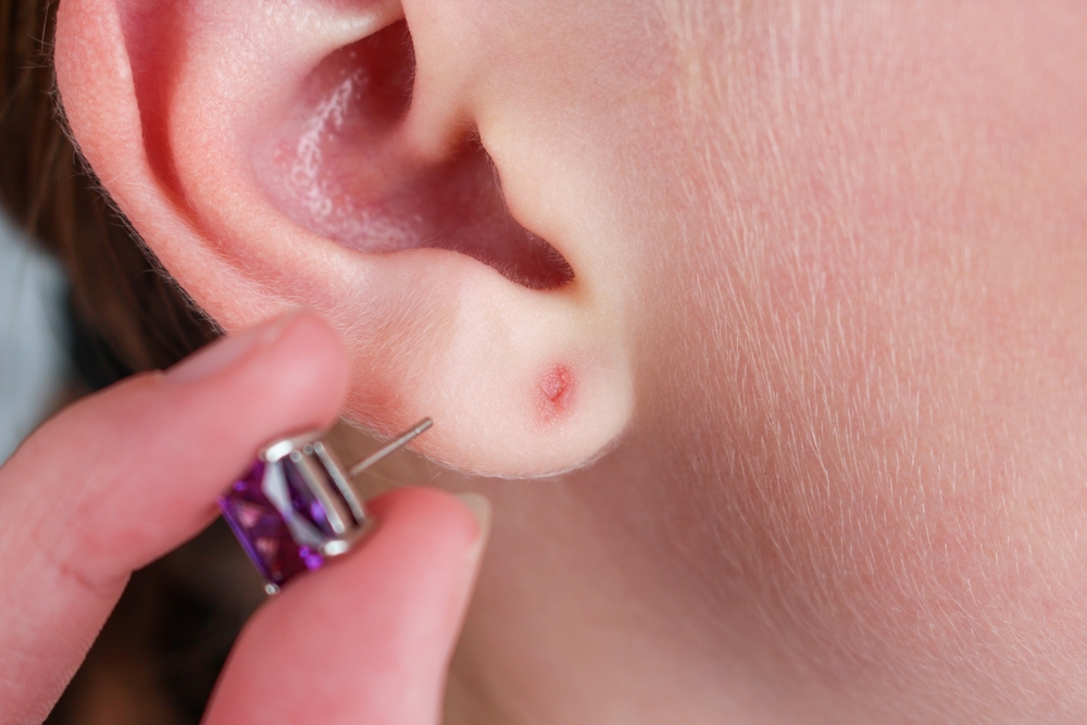 Understanding Piercing Swelling Stages: A Complete Guide to What Happens After You Get Pierced